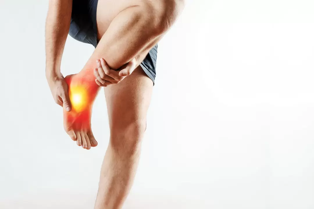 Gelenkartikulation und ihre Behandlung mit Congelum -Gel
