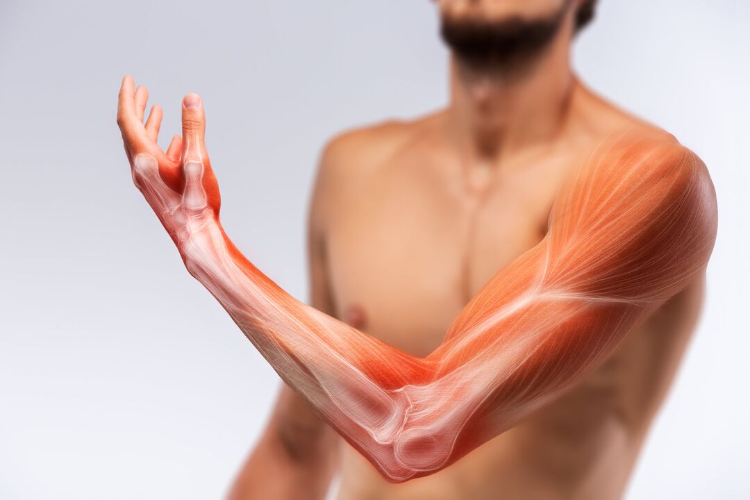 Handmuskeln und ihre Behandlung mit Gelbestand