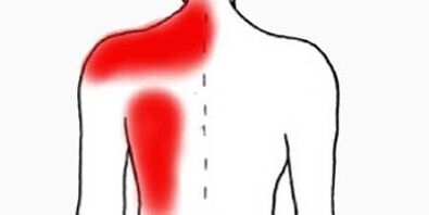 Schmerzen unter dem linken Schulterblatt von hinten