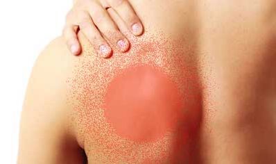 Schmerzen unter dem linken Schulterblatt